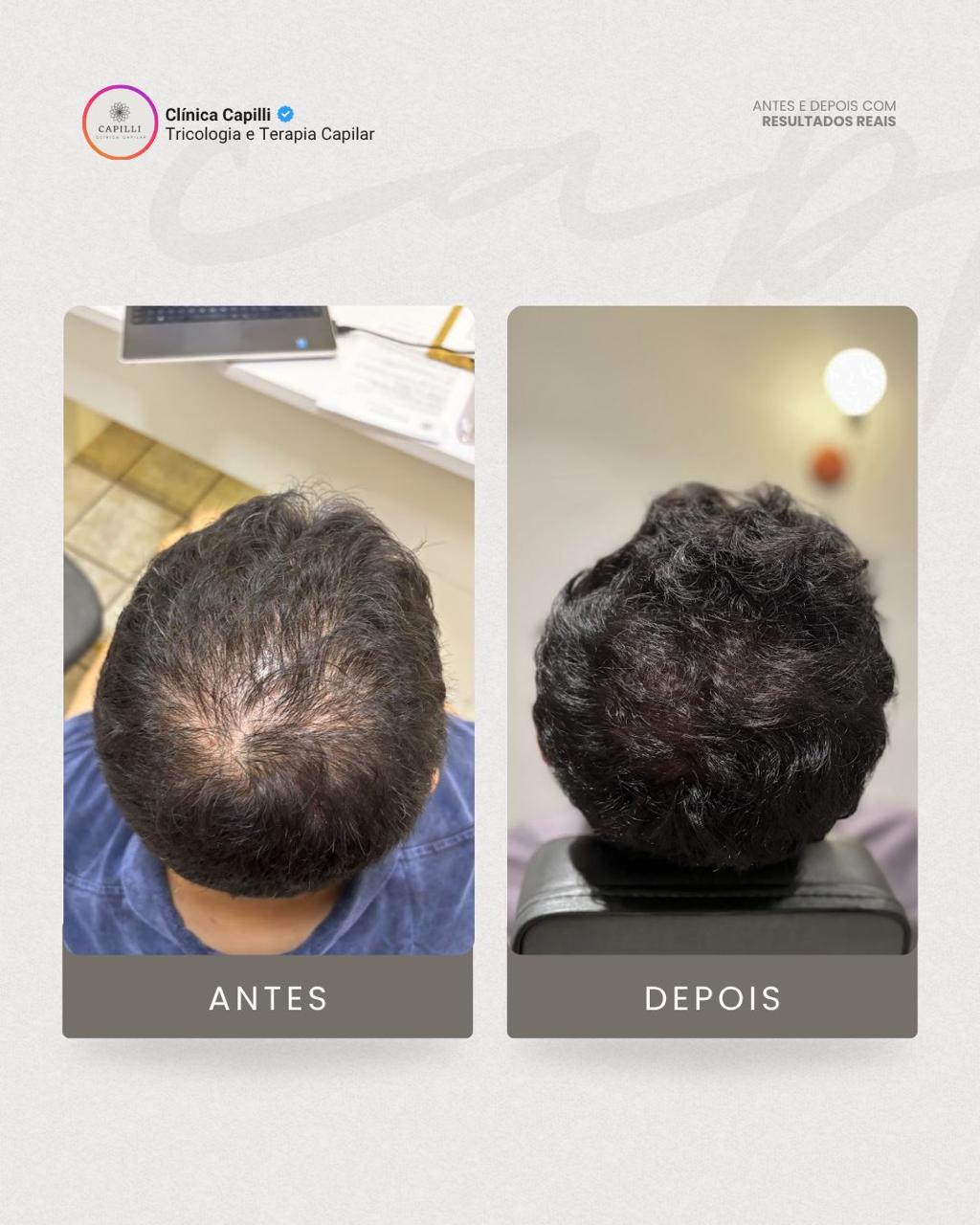 Resultado de tratamento capilar na Capilli - Constância no tratamento
